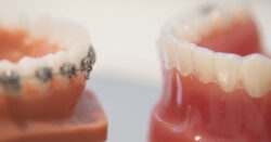 clinica dental velez y lozano murcia invisalign ortodoncia brackets copia